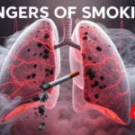 DANGERS OF SMOKING